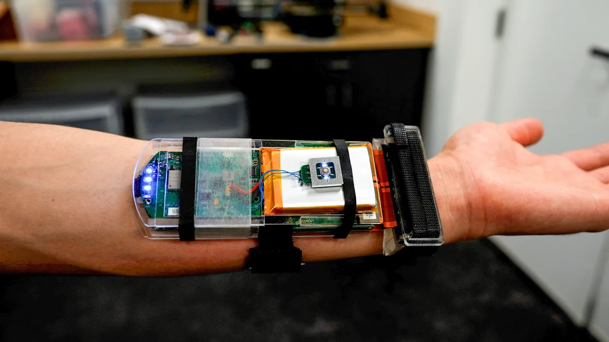 arm extended to display a device strapped to the interior of the forearm
